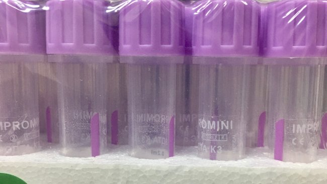 Микропробирка 0,2мл К3-ЭДТА (10х45мм), ИмпроМини, фиолетовая, БЕЗ капилляра, лоток, упак. 50шт., №1 Микропробирка 0,2мл К3-ЭДТА (10х45мм), ИмпроМини, фиолетовая, БЕЗ капилляра, лоток, упак. 50шт., №1
