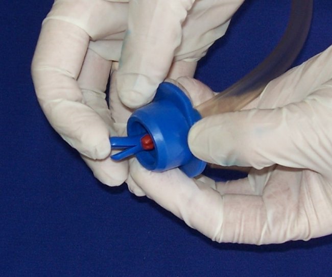 Устройство для дренирования ран УДР-500 (гофр. баллон 500мл + узлы дренирования), МИМ, г.Тюмень Устройство для дренирования ран УДР-500 (гофр. баллон 500мл + узлы дренирования), МИМ, г.Тюмень