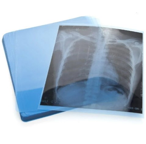 Пленка рентгеновская